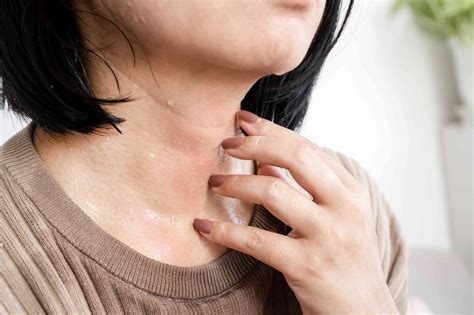 Why Do You Have a Rash on Your Neck?