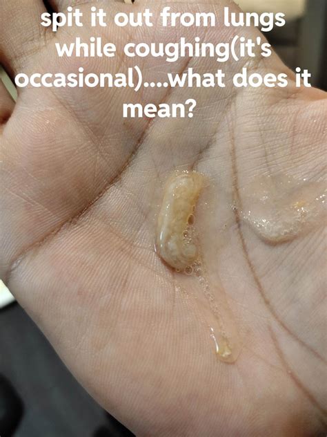 sputum from lungs. what does it signify? ashtma or COPD or bronchitis!? Help : r/Asthma