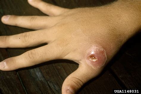 red imported fire ant (Solenopsis invicta)