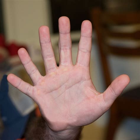 The Spiritual Meaning of Six Fingers - Awakening State