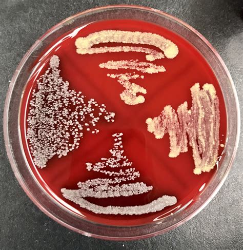 Bacterial growth on Sheep Blood Agar plate