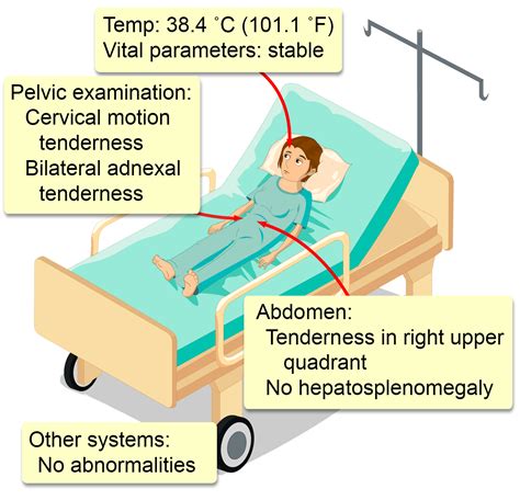 Fitz-Hugh-Curtis Syndrome - Interactive case study | Clinical Odyssey ...
