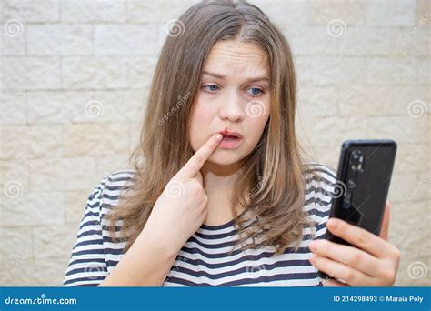 Doctor`s Consultation by Phone. Herpes Virus on the Lips of a Girl. Young Woman with Herpes ...