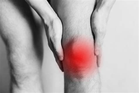 Gout in knee: How to diagnose - Sport Doctor London