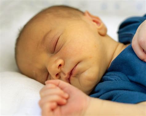 Ictericia: ¿Por qué se produce la coloración amarilla en la piel?