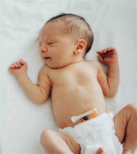 Sacral Dimples in Newborn: Symptoms, Causes And Treatment