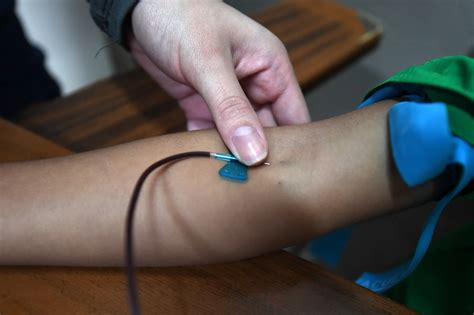 Trump Talk of Autism Treatment Leucovorin Sparks Demand for FRAT Test ...