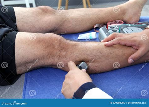 Electromyography EMG and Somatosensory Evoked Potential PEV of Lower Extremities,to Explore the ...