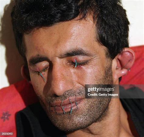 Mouth Sewn Shut Photos and Premium High Res Pictures - Getty Images