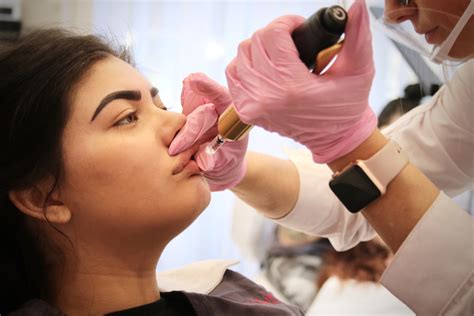 Lip Filler Without Needles: Get Plumper Lips with the Hyaluron Pen Method | MicroBladers Studio ...