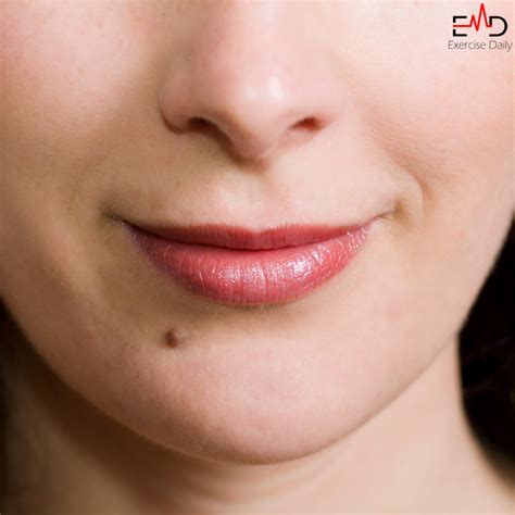White Bumps on Lips - Causes and Management