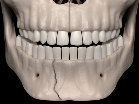 Facial Trauma » Minneapolis Oral Surgeons » Minnesota Oral & Facial Surgery