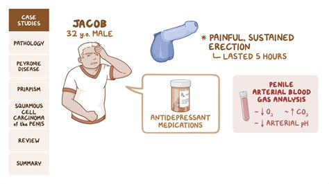 What Is Penile Narrowing at Geraldine Givens blog