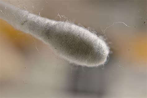 How Does the Kastle-Meyer Test Detect Blood?