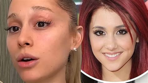 Did Ariana Grande Get Plastic Surgery? | SurgeryTR