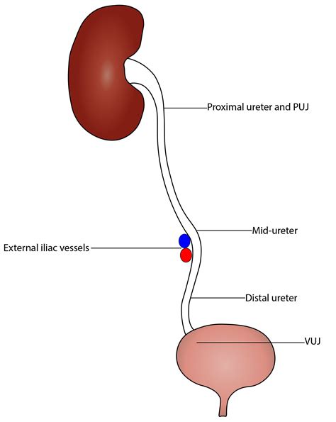 Ureter Proximal E Distal - NAZAEDU
