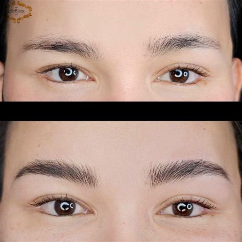 Eyebrows Raised: Retinal Risks In Laser Hair Removal Laser Hair Removal Guide