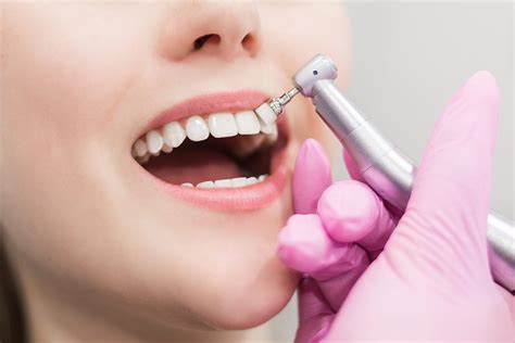 Dental Scaling and Polishing - cosmedicadental.com