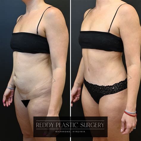 Reddy Plastic Surgery (@reddyplasticsurgery) • Instagram photos and videos