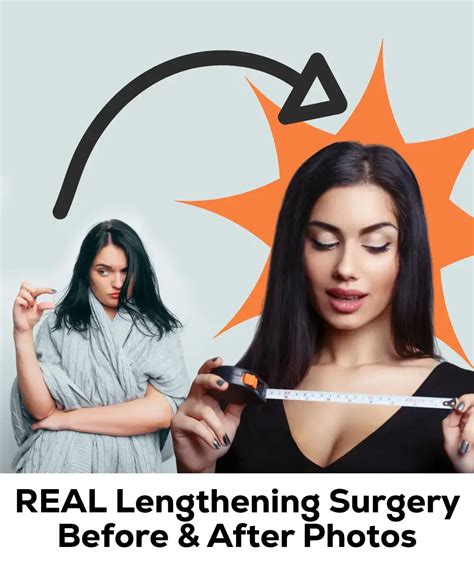 Penis Enlargement Cut Online | centralcountiesservices.org