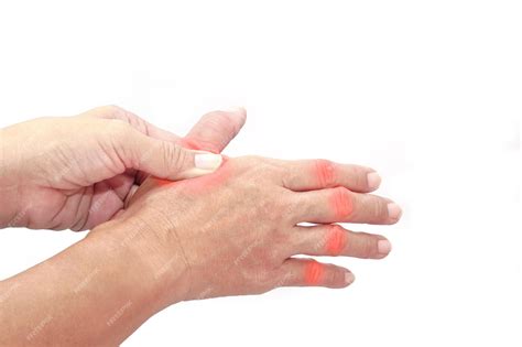 Premium Photo | Woman finger suffering from knuckle pain on white background Healthcare and ...