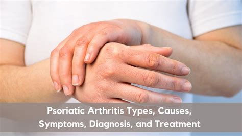 Everything You Need to Know About Psoriatic Arthritis - VIMS