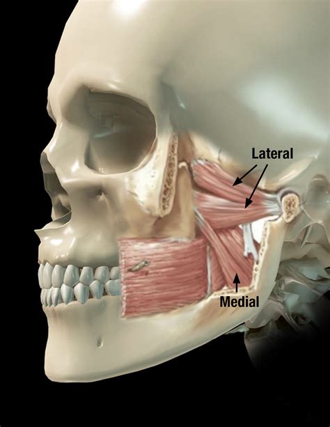Medial Pterygoid Palpation