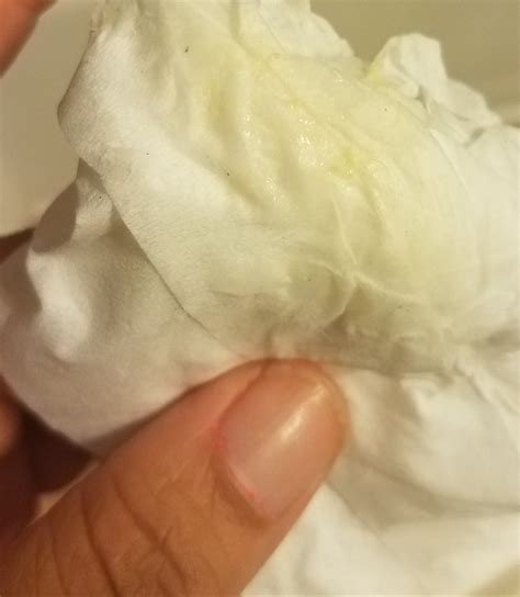 Discharge Is Greenish