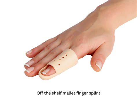 Mallet Finger | Perfect Therapy
