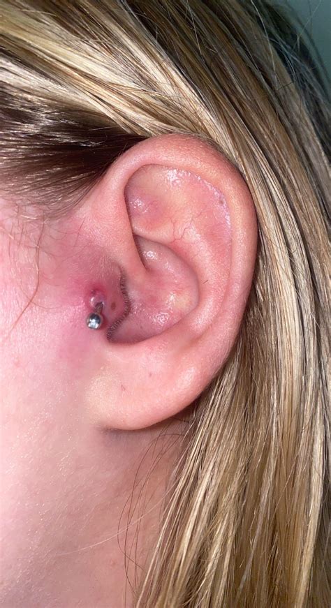 Tragus Ear Piercings Infection Double Tragus | Gallery Posted By