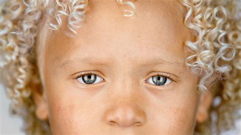 Black Person With Blue Eyes And Blonde Hair