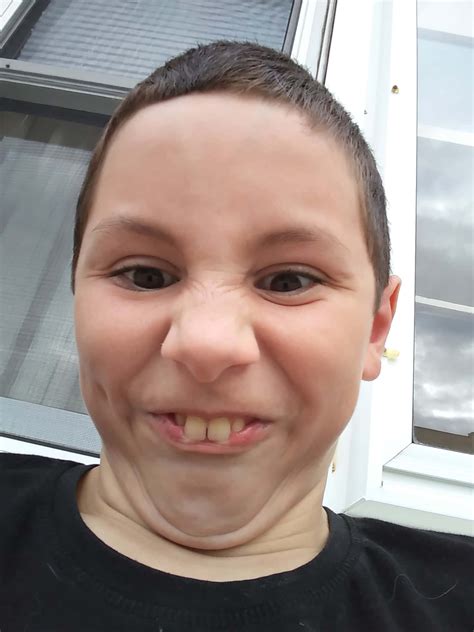 Download Boy Bunny Teeth Face Funny Pictures | Wallpapers.com