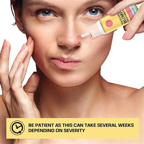 Infected Nose Piercing Bump Inside Nose