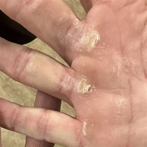 Mastering Callus Care: 3 Signs Your Calluses Need Attention – SandBar Hand Care