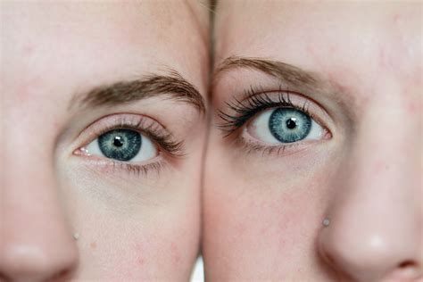 why identical twins don't always look the same
