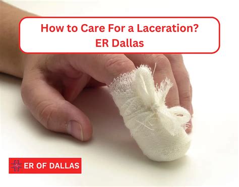 Laceration Care: How to Treat a Cut - ER Dallas