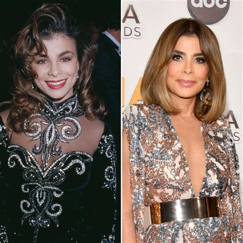 Paula Abdul Face Surgery