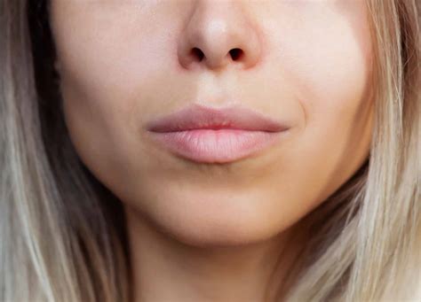 4 Signs of Good Buccal Fat Removal Results | RealSelf News