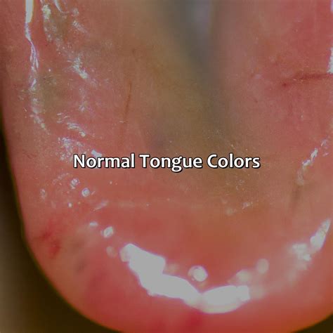 What Color Should The Tongue Be