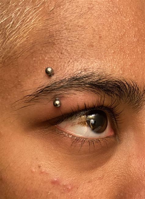 Infected eyebrow piercing? : r/piercing