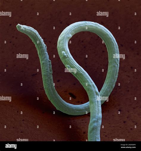 Dog lungworm (Angiostrongylus vasorum) adult, coloured scanning ...