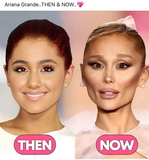 Ariana Grandé | Cute couples cuddling, Celebrity plastic surgery ...