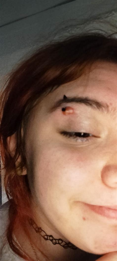 Need advice on infected eyebrow piercing : r/PiercingAdvice