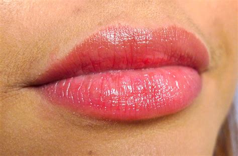 Mouth Allergic Reaction Lips at Jerry Fifield blog
