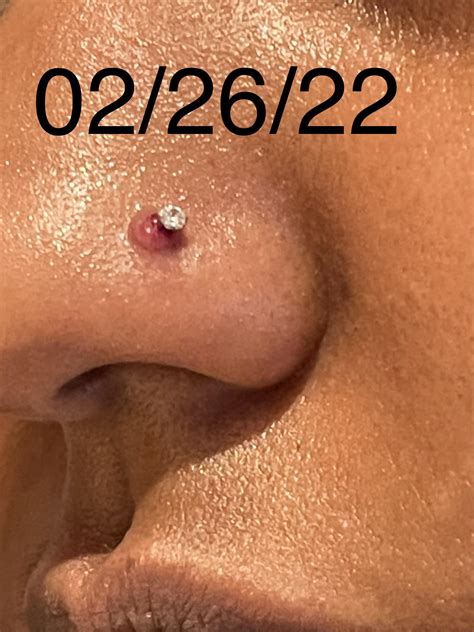 Infected Nose Piercings