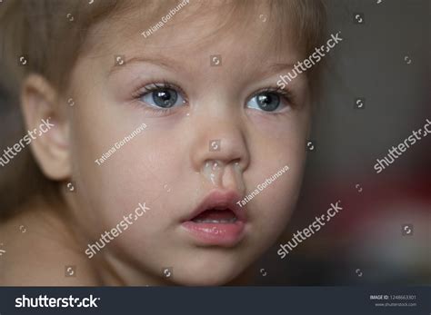 371 Baby Have Runny Nose Images, Stock Photos & Vectors | Shutterstock