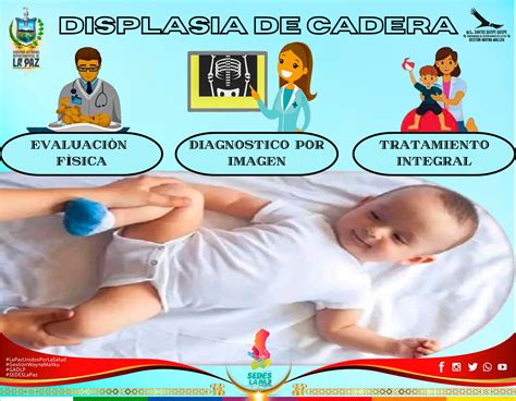 ¿QUE ES LA DISPLASIA DE CADERA? - SEDES LA PAZ