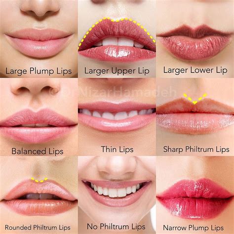 Dr Nizar Hamadeh on Instagram: “Common lip characteristics. Which Lips ...