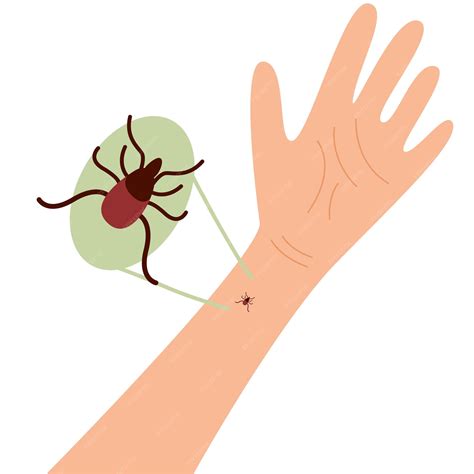 La mano humana con la picadura de garrapata picadura de garrapata mano picadura de garrapata ...