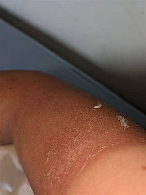 Guess I'm a snake now.... : r/memes